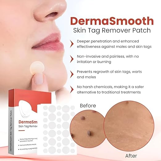 DermaSmooth Skin Tag Remover Patch